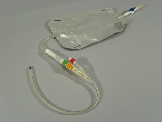 CareVent ® catheter valve connected to silicone catheter and urine bag